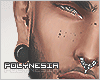 ✗ Freckles