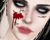 A| Only Blood