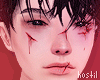 Abuse