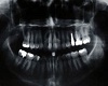 teeth xray