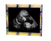 single ultrasoud pics 