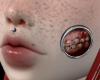 Bloody cheek plugs
