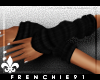 f. WarmMyArm{Onyx}