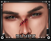 !!S Baby Its Hurt!
