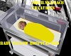 Baby yellow hospital bed