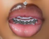 blk braces