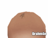 woman balding