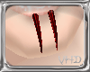 [VHD] Blood Bites|Male