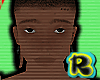moles skin