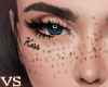 {VS} Kiss Freckles