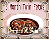 5 Month Twins In Tummy