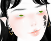 albina