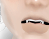 my teeth