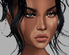 Vitiligo Skin I