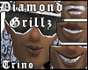 DIAMOND Grillz Johnny H