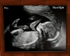 MagssNight ultrasound