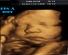 Boy Ultrasound Pic
