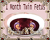 1 Month Twins In Tummy