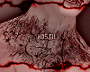 H. Rotten Neck