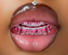 PNK braces