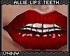 V4NY|Allie Lips Teeth1