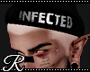 [R] Beanie Infected