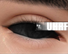 Black eyes