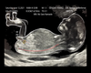 Custom MzSara UltraSound