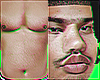 Von Fat Body