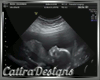 It's A Boy Ultrasound