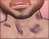 P| hickeys all over