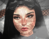 Skin Freckles