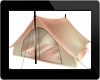 Tent*