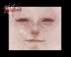 smile>mole