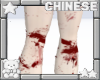 ᢉ𐭩 bloody legs v2