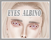 eyes albino