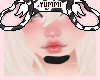 Summer Bandaid Black