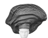 ß | Gele 2 DRV