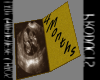 Ultrasound4Months1Baby