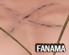 FA | Tattoo wound