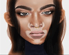 ♥ Winnie Vitiligo (mh)