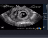 Jr. UltraSound