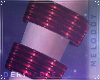 M~ DRV Kennya - BraceR