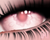 🅜 NEKO: eyes albino