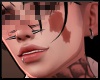 ⊣ birthmark