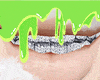 n̷r̷/ Grillz Fashion