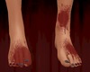 Miss Bloody Feet