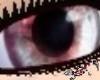 Crimsia Spot eyes