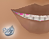 Braces in Pink (Jasmine)