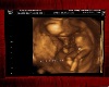Xiena Ultrasound